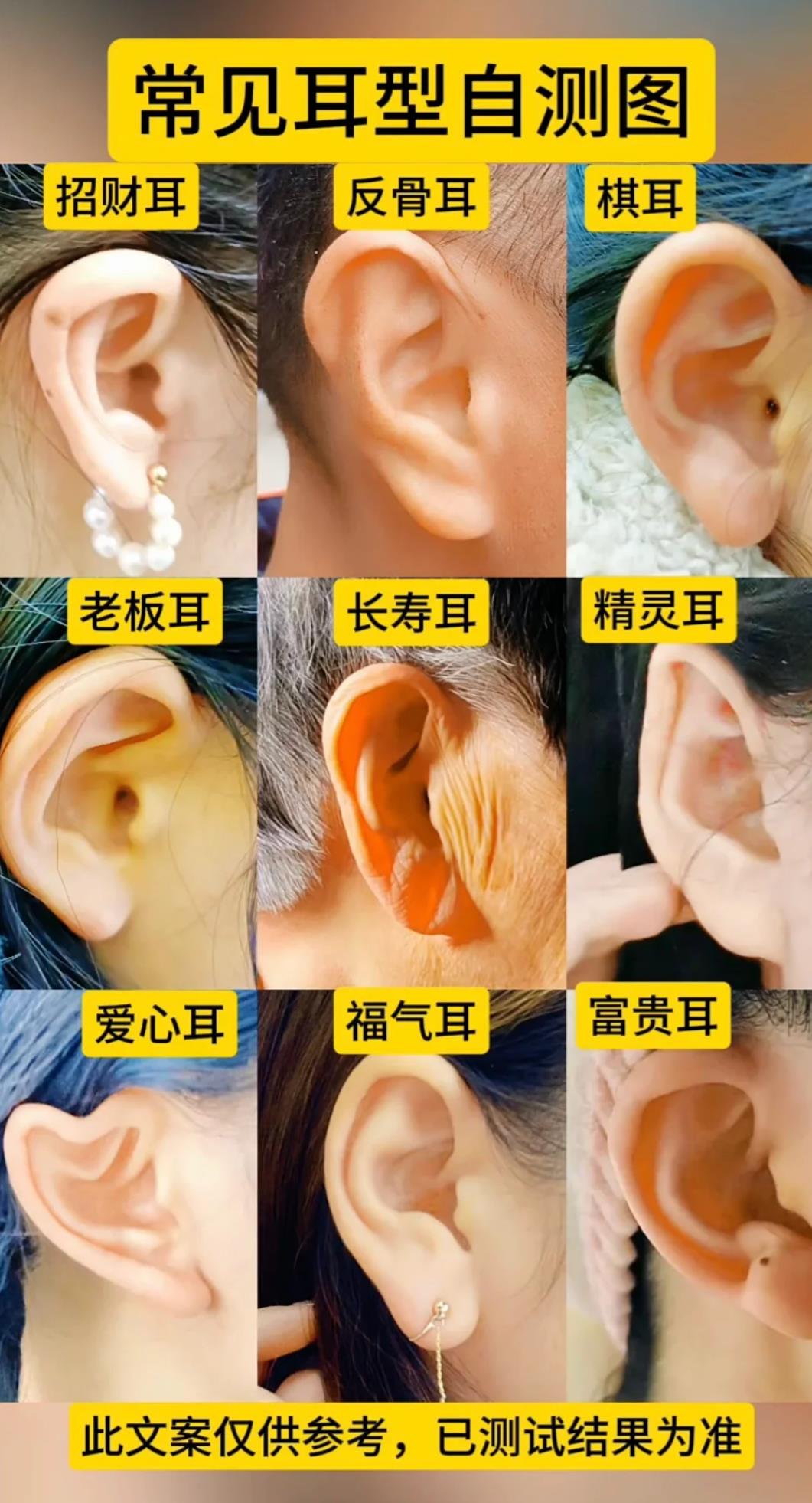耳朵形状有哪几种