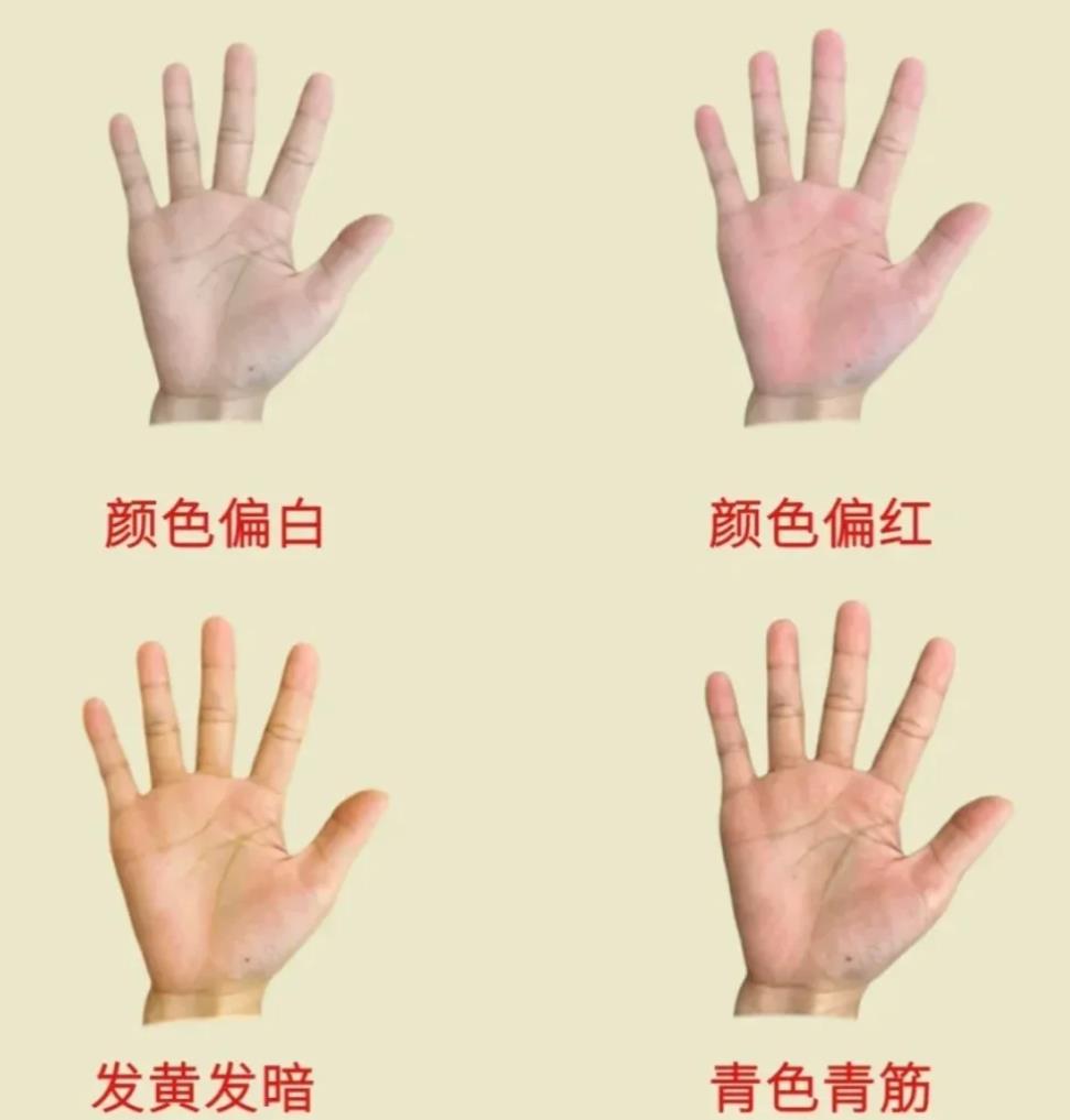正常手掌颜色照片,正常人的手掌是什么颜色