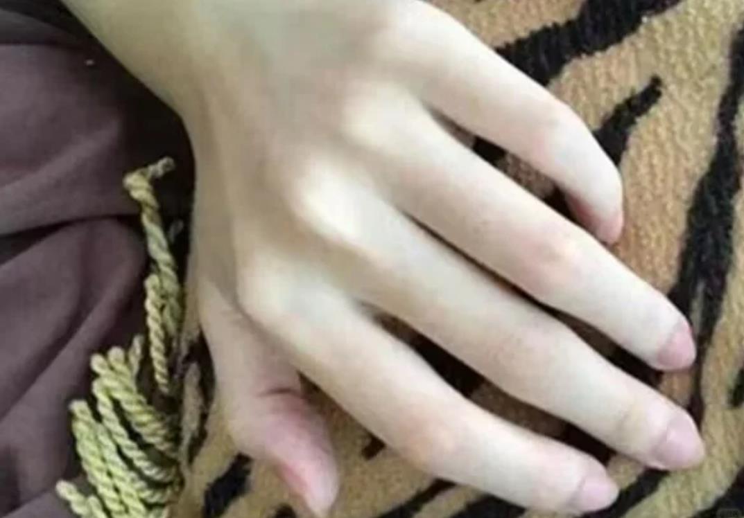 女人手指比手掌长代表什么