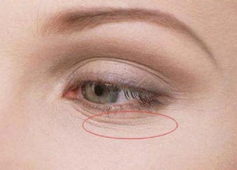 什么是女性阴骘纹