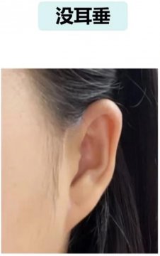 无耳垂面相图解