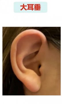 耳垂厚女人的图片