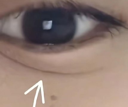 标准的阴骘纹的面相图片