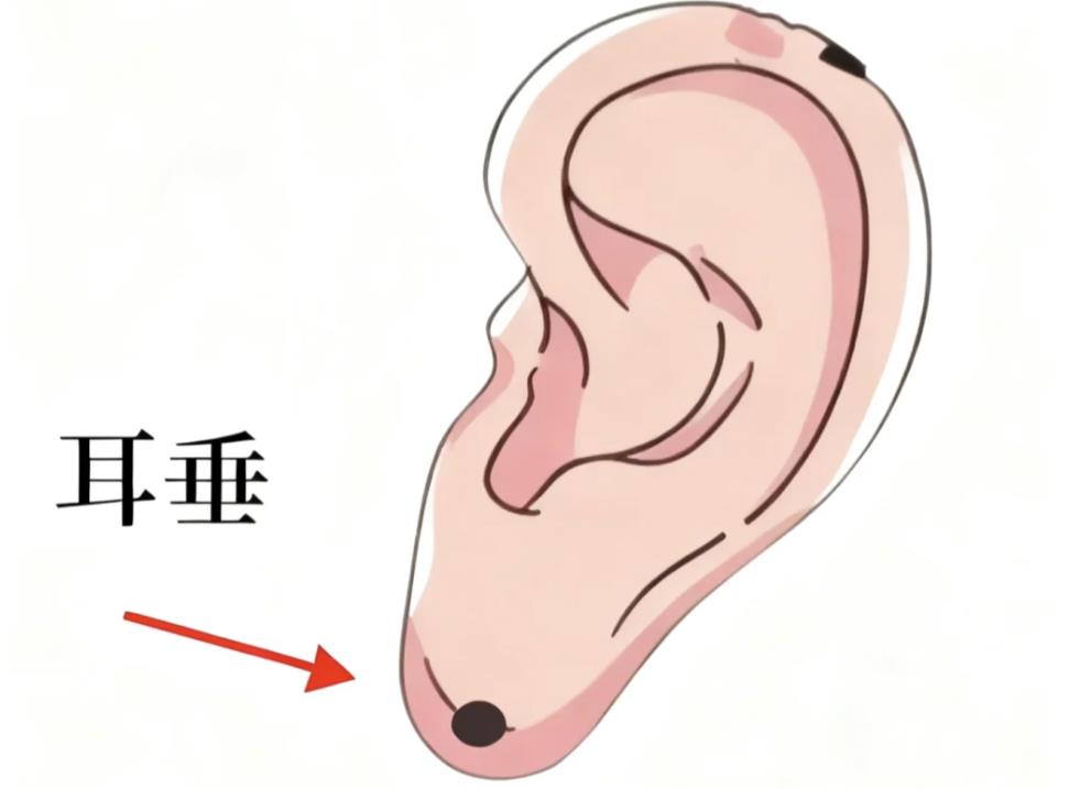 耳垂有褶皱有一条横纹,耳垂痣代表什么